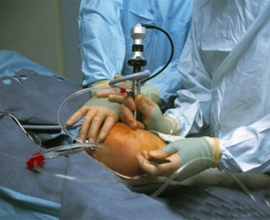 В Италии проведена операция по полной пересадке коленного сустава
